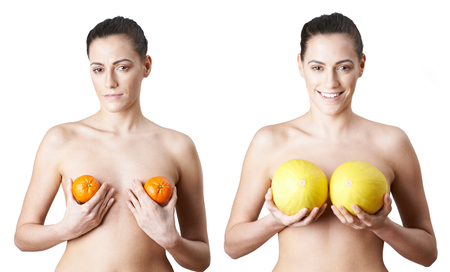 Woman Holding Satsumas And Melons To Illustrate Breast Enlargement Surgeryの写真素材