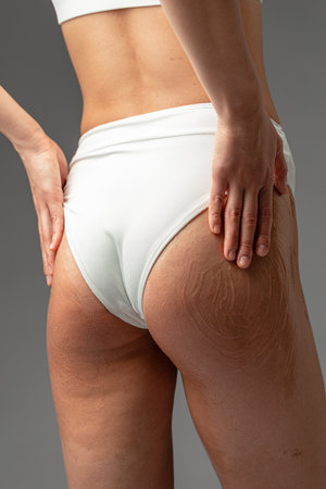 Pink care lotion applied on young woman buttock