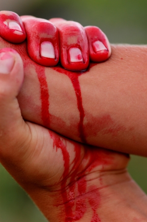accident, injury and bleeding human hand, the blood flowingの写真素材