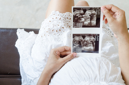 Close up of pregnant woman holding ultrasound scanの写真素材
