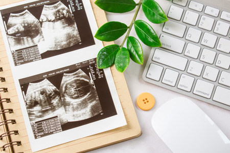 Ultrasound scan film with notebook on white table background.のeditorial素材