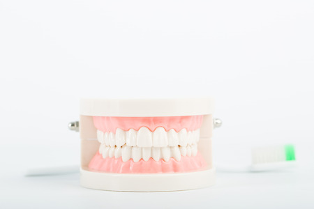 Dental implant model for explain tooth body.