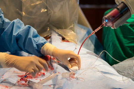 Dotor prepare equipment for percutaneous tranluminal coronary angioplasty to operate patient  who is heart disease .の写真素材