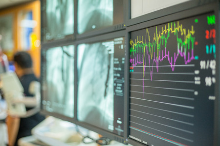 Monitor Heart rate patient in operation room.の写真素材