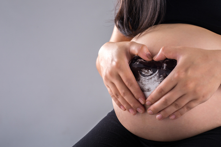 Pregnant Asian woman show x- ray film in studio .の写真素材