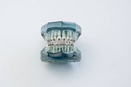 Artificial human jaw with perfect teeth and braces