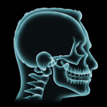 Side of human head or skullâ isolatedâ onâ blackâ graphic background.Green x-Ray film forâ checkâ orâ analysis brokenâ boneâ forâ medical, healt care, protectionâ orâ treatment.3Dâ illustration.の写真素材