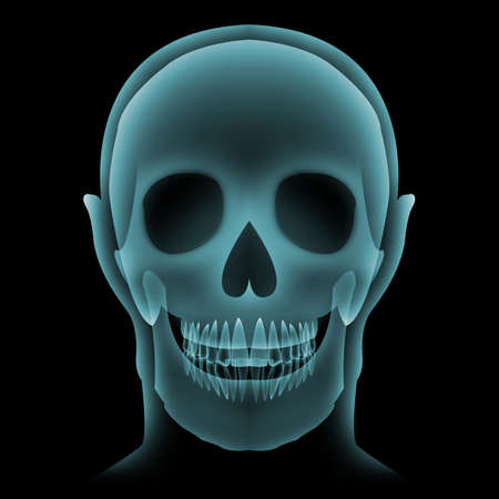 Front view of human head or skullâ isolatedâ onâ blackâ graphic background.Green x-Ray film forâ checkâ orâ analysis brokenâ boneâ forâ medical, healt care, protectionâ orâ treatment.3Dâ illustration.の写真素材