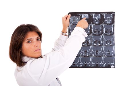 woman doctor looking at an x-ray (isolated on white)