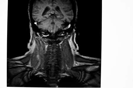 muscle and spinal columnの写真素材