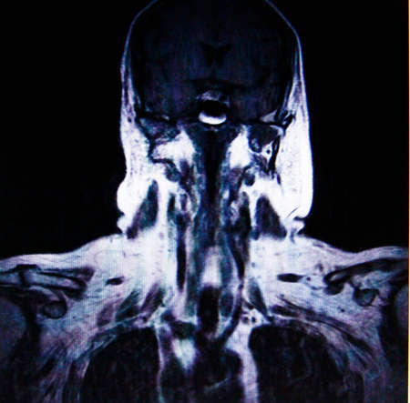 upper body tomographyの写真素材