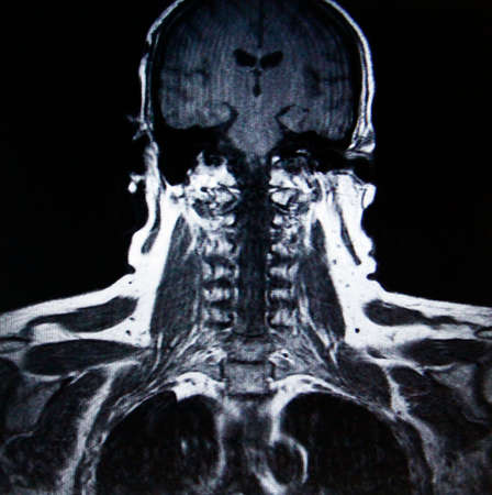 MR imagingの写真素材