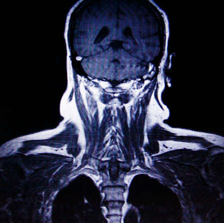 human upper body MR imagingの写真素材