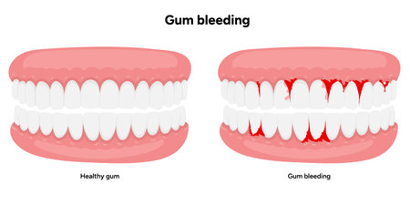 Hand-drawn illustration of healthy teeth and gums alongside bleeding gums, dental and oral anatomy....