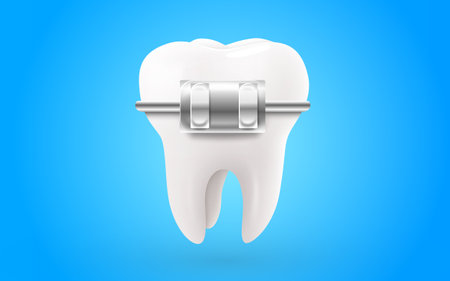 Tooth with braces.のイラスト素材