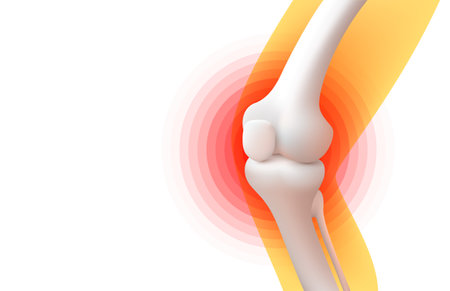 knee pain, X-ray of the leg, 3D visualization. Vector illustrationのイラスト素材