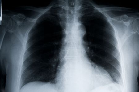 detailed x-ray of a human chest landscapeの写真素材