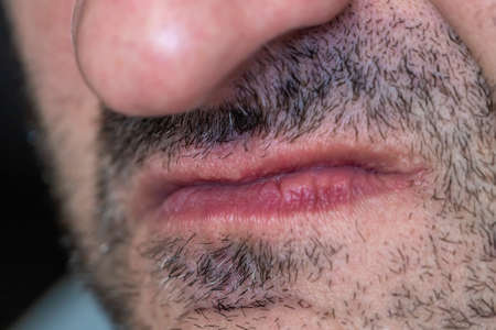 A close-up of tightly pressed lips on a displeased mans face. Emotion of anger, disgust, contempt or arrogance. Narrow lips on unshaven face, negative emotion. Angry mans face. Selected focusの写真素材