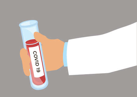Blood sample test tubes in tester hand. blood sample for COVID-19 test. Vector illustrationのイラスト素材