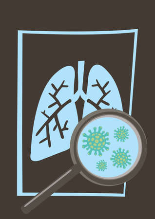 Coronavirus disease COVID-19 infection medical in lungs of X-rays. Vector illustrationのイラスト素材