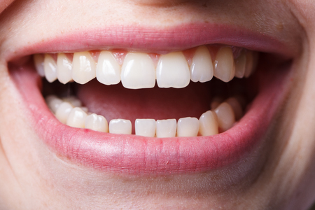 dentistry, mouth and teeth close up smiling