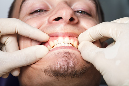 a dentistry, patient examination and treatment at the dentistの写真素材