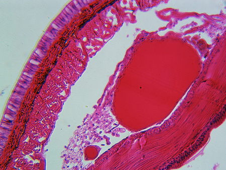 Earthworm under Microscope