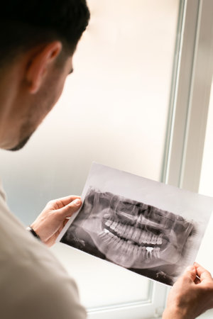 Dentist looking an X-ray of jaw teeth with an implanted tooth . Dentist services conceptの写真素材