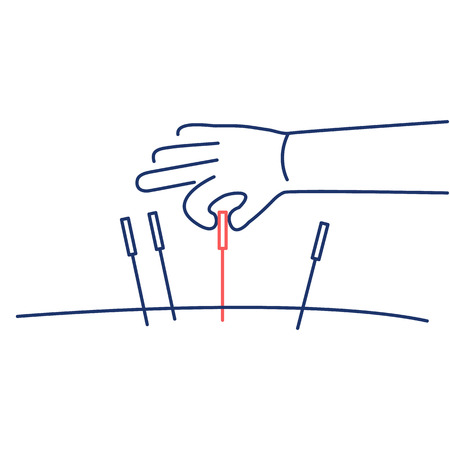 Acupuncture healing red and blue linear icon on white background | flat design alternative healing illustration and infographicのイラスト素材