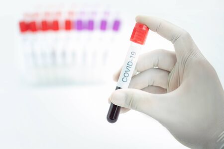 Hand holding blood collection tube to test Corona virus infection on white backgroundの写真素材