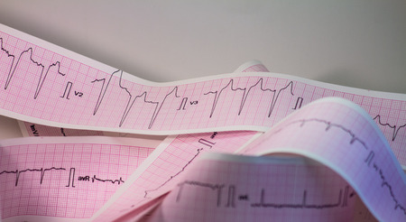 Electrocardiogram with heartbeat. Graph paper for recording cardiac activity.