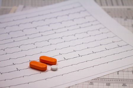 Small pills or legal drugs on strips of electrocardiograms that are out of focus.の写真素材