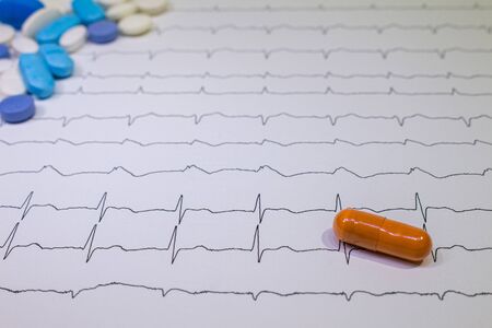 Electrocardiogram with Brugada syndrome. Colored pills on an EKG path. Sudden cardiac death due to arrhythmias. Myocardial diseaseの写真素材