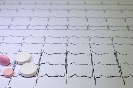 Electrocardiogram with Brugada syndrome. Colored pills on an EKG path. Sudden cardiac death due to...
