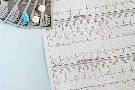 Cardiac arrhythmias recorded on paper. Ventricular Tachycardia American dollars on the medical desk. Copy spaceの写真素材