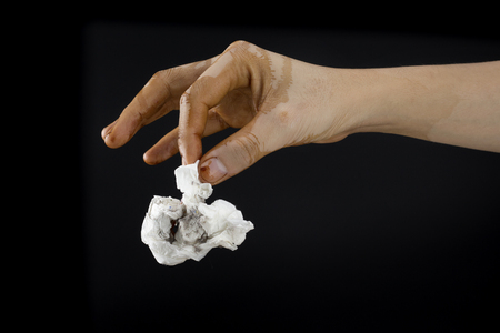 dirty hand with germs and bacteriaの写真素材