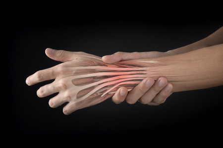 wrist muscle painの写真素材