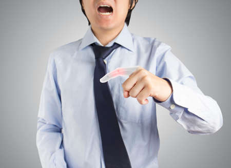 office worker in pain due to injury to finger boneの写真素材