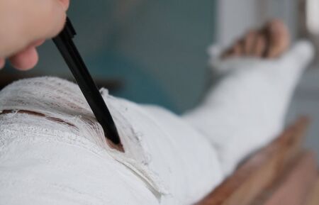 Young man with broken plaster leg trying to scratch injured itching places by penの写真素材