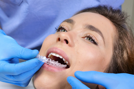 In a professional practice, a dentist puts the latest generation of transparent dental appliances...