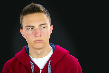 Portrait of teenage boy with acne on black background. Sad face. Copy place