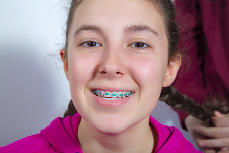 Portrait of a beautiful teenage girl with braces smilingの写真素材