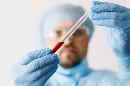 Close up of doctor hand holding blood sample. Medical equipment. Blood test. A doctor wearing...