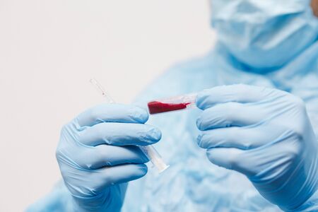 Close up of doctor hand holding blood sample. Medical equipment. Blood test. A doctor wearing...