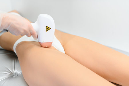 Young woman making body hair removal laser depilation in beauty center.の写真素材