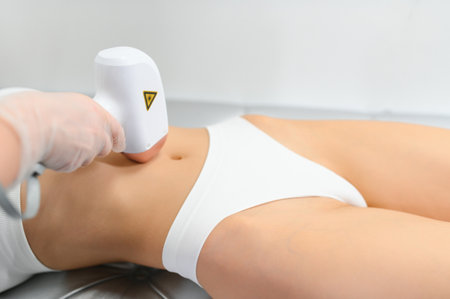 laser hair removal. Woman on laser hair removal treatments thighs and bikini area.の写真素材