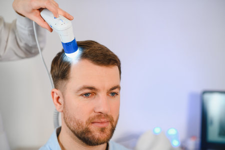 Trichoscope examination of hair, scalp and hair follicles of a young man. Copy space banner.の写真素材