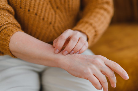 Close up of person's hand scratching forearm, showing an allergic reaction, eczema, or dry skin causing discomfortの写真素材