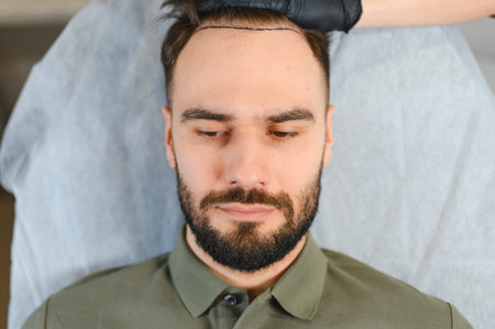 Man with marked hairline on his scalp, preparing for a hair transplant procedure to treat baldness at a medical clinicの写真素材