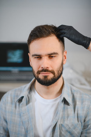 Doctor in black glove examining male patient's scalp, checking for hair loss and potential baldness in a clinic settingの写真素材